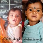 चिरायु दल ने लौटाई मासूम रंजना की मुस्कान,शासन की योजना से दूर हुई आर्थिक तंगी और बेटी के भविष्य की चिंता